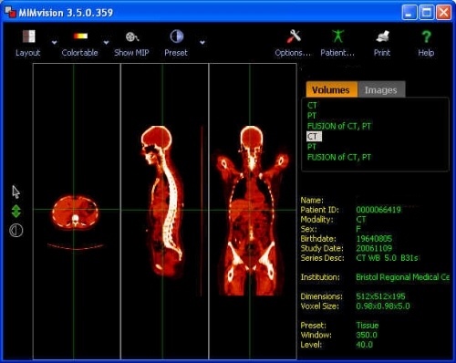 petscan