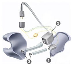 ultimate_ears_pro7_diagram ultimate ears pro7 diagram1