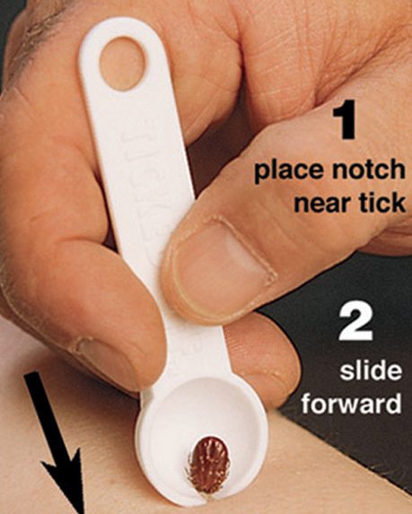 ticked off tick remover 2