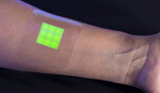 smart-bandage