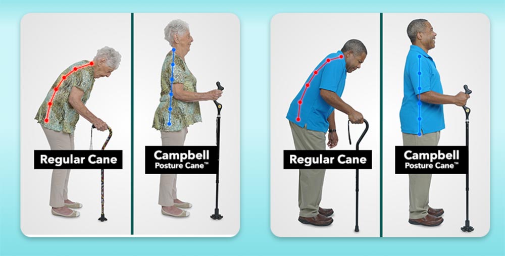 Walk more upright with the Campbell Posture Cane - The Gadgeteer