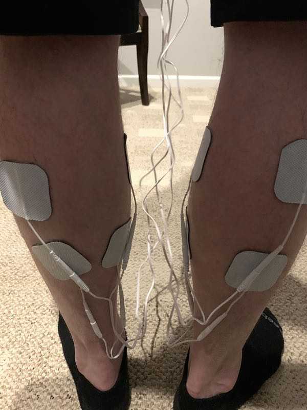 AUVON 4 Outputs TENS Unit EMS Muscle Stimulator Machine review - The  Gadgeteer