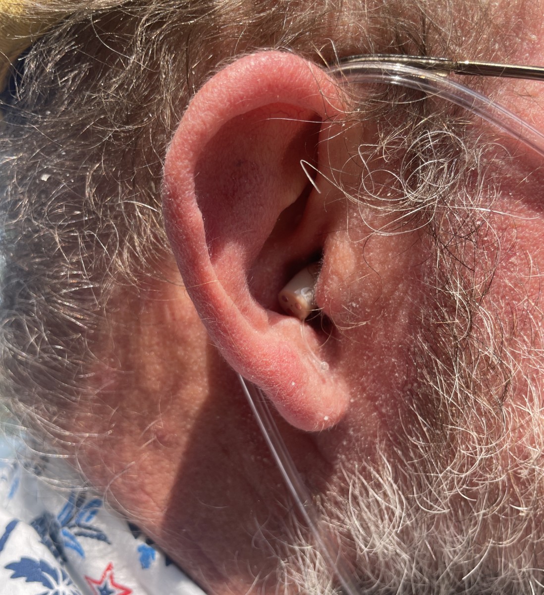 Ceretone Core One Hearing Aids 18
