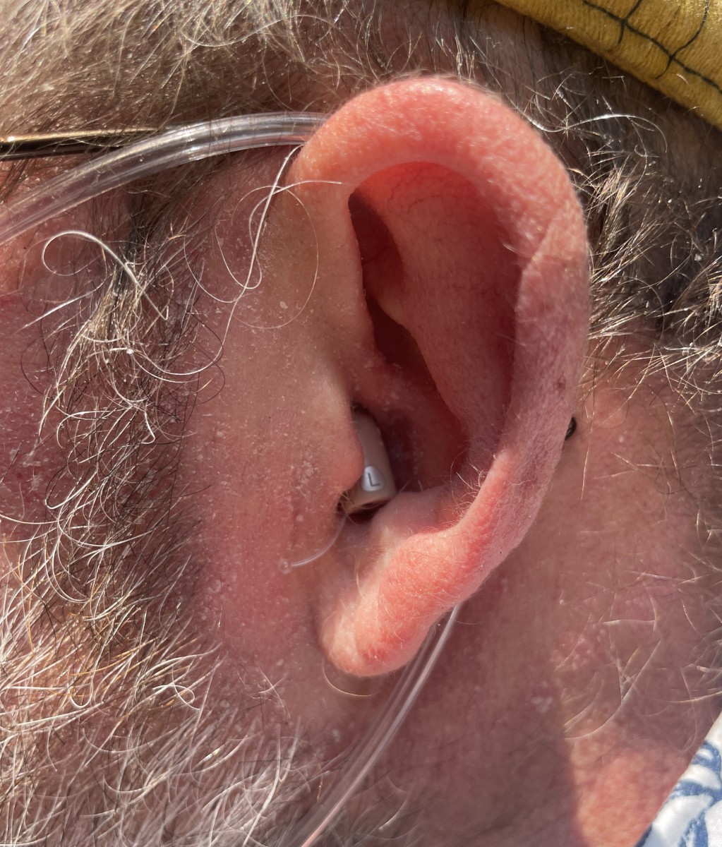 Ceretone Core One Hearing Aids 19
