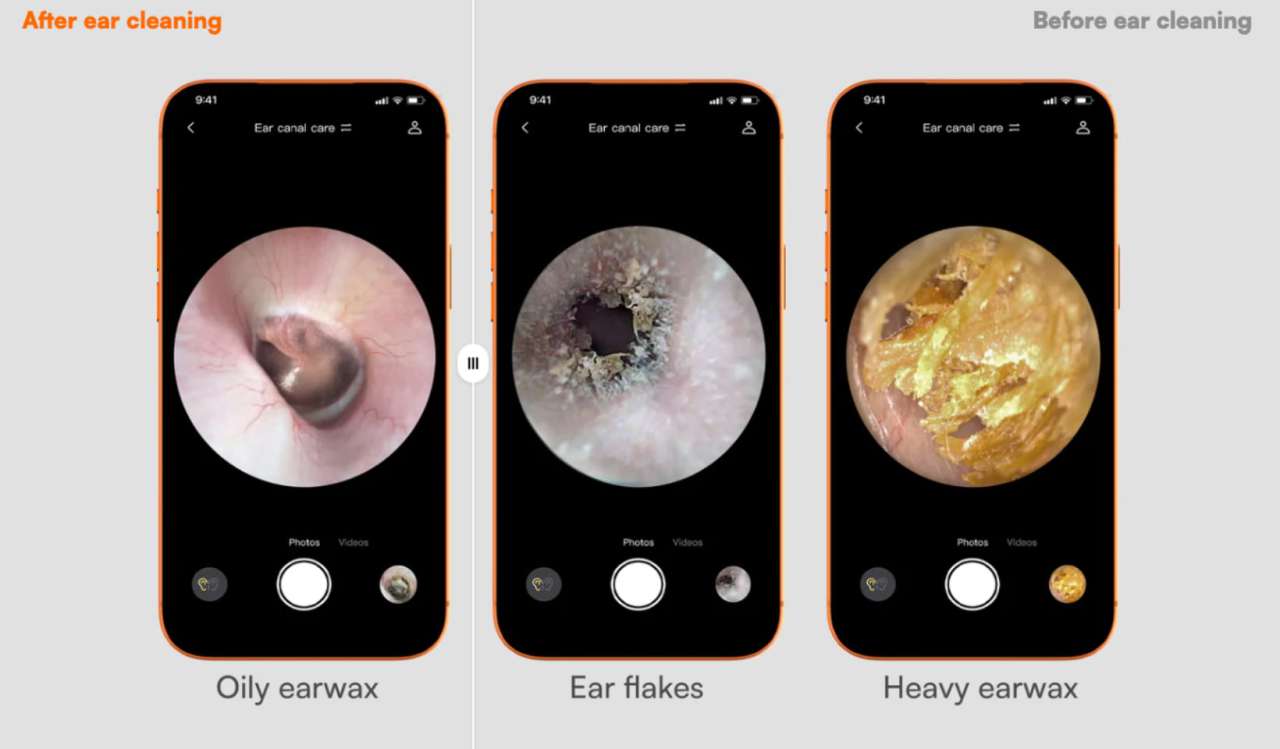 Bebird EarSight Ultra X 6