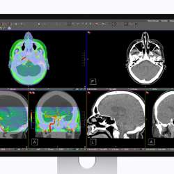 Apple Studio Display XDR DICOM Medical Imaging