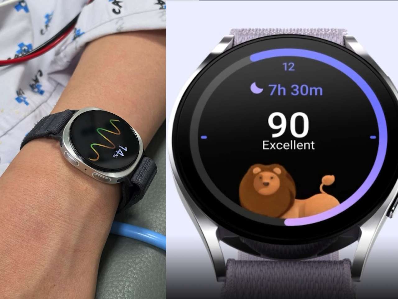 Samsung Galaxy Watch6 Fainting Prediction Study Results